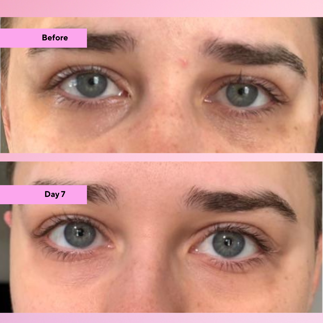 Illuminate V2 Multi-Peptide Eye Serum | 15% Peptide System